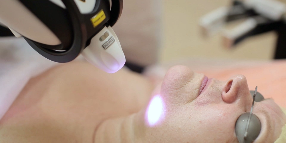 Nd YAP Q-geschalteter Emitter