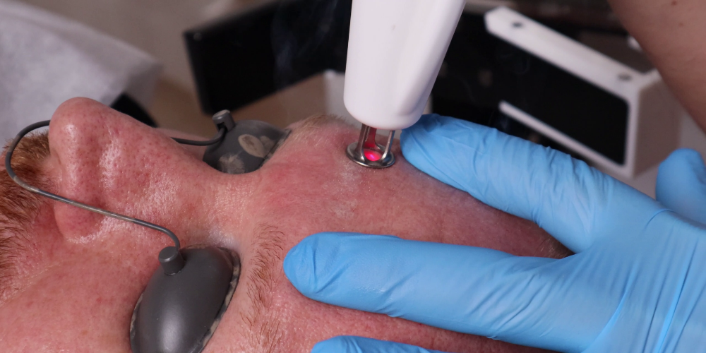 RecoSMA® – Ein Durchbruch in der Laser-Regenerations-Technologie