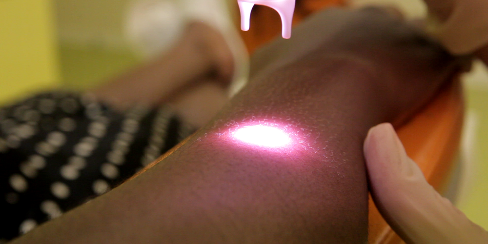 Haarentfernung für jeden Hauttyp (QOOL-epilation®)