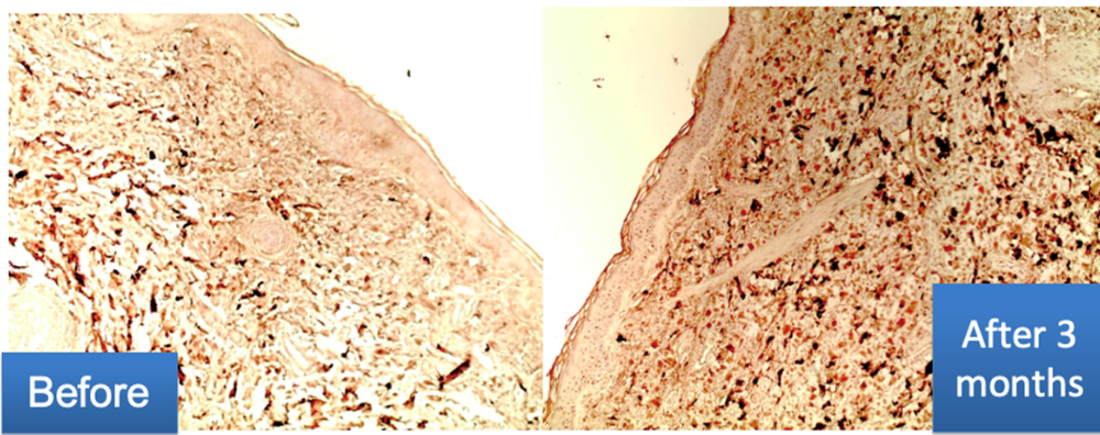 Immunhistochemische Untersuchung